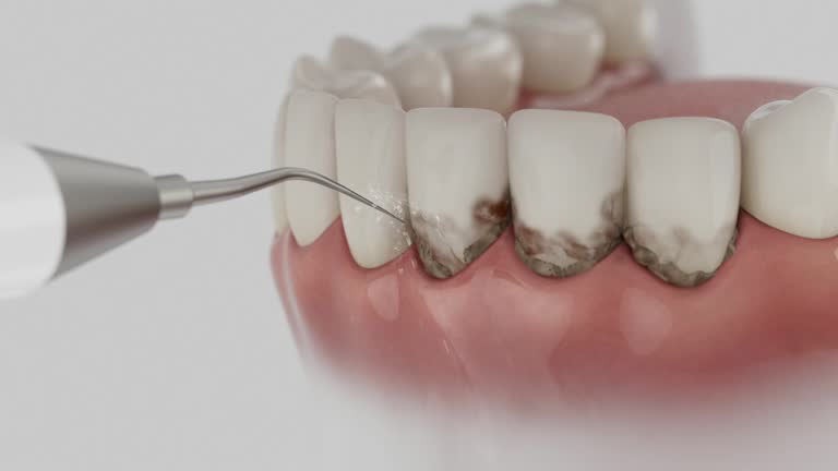 Reliable Dental Implants contractor in Lower Lake, CA by Smile Center Dentistry